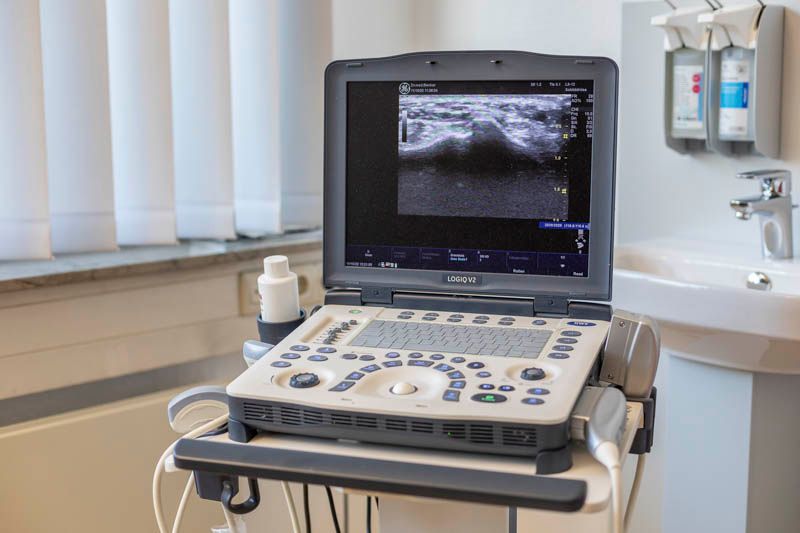 handchirurgische Praxis Peiner Straße Hannover - Ultraschallgerät